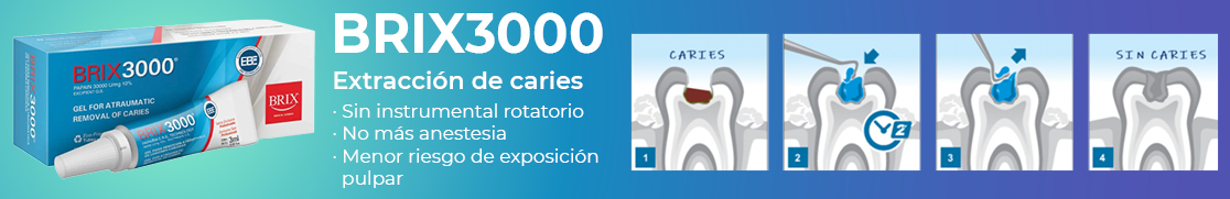 MEZCLADORA / BATIDORA AUTOMATICA DE ALGINATO CAVEX CAVEX - Dentaltix