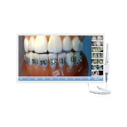Camara intraoral autofocus 100336  Mestra - 