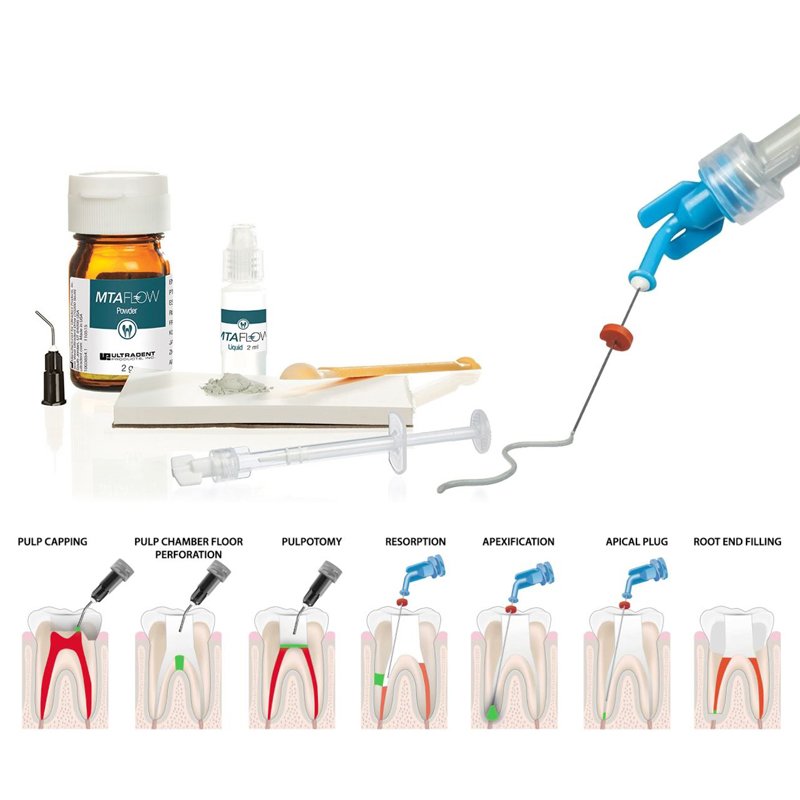 Endo-Eze MTA FLOW Kit 3980-1 Ultradent - Para 8-10 aplicaciones.