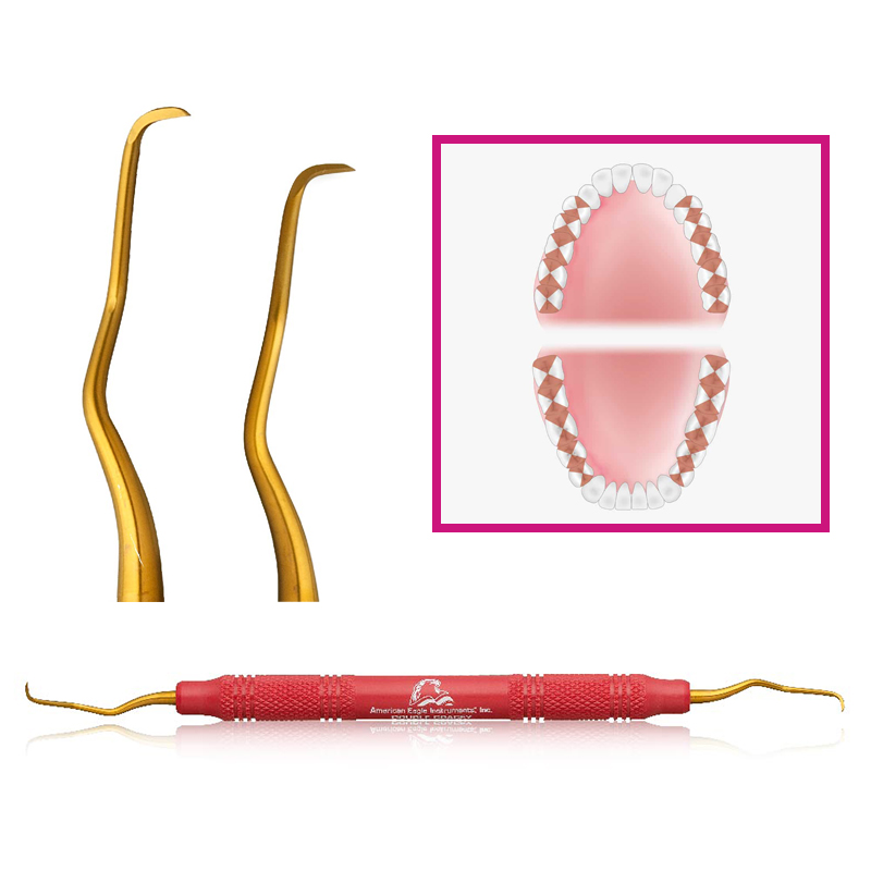Cureta gracey DBL mini POSTERIOR XP² AEDGMPXPXE American Eagle - UNIDAD