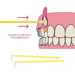 C&C - BASE COMPOSITE CON CADENA DCCP Grande Reliance Orthodontic - 1 unidad
