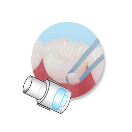 Mini-Mold de Botón Lingual  Reliance Orthodontic - 25 Moldes + 1 Mango.