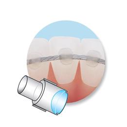 Mini Mold para Retención Lingual 4,5 mm  Ortho Technology - 10 Moldes + 1 Mango.