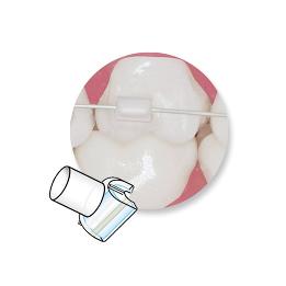 Mini-Mold para Tubos Bucales - 51391 Ortho Technology - 10 Moldes + 1 Mango.