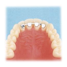 Lateral-Lateral superior kit surtido Leone - 20 piezas.