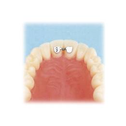 Retenedor lungual central-central superior kit introducción F3812-93 Leone - Kit surtido de 20 piezas.