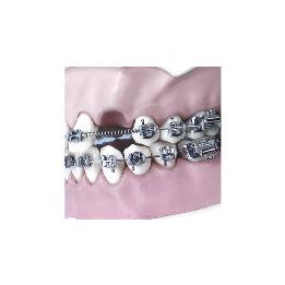 Resorte Níquel-titanio abiertos en espiral. Leone - 2 resortes de 18 cm.