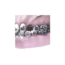 Resorte Níquel-titanio cerrados con terminales.  Leone - Confección de 10 unidades.