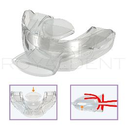 Myotalea® Tongue, Lip & Jaw Appliance - TLJ Myotalea - unidad y para todas las edades