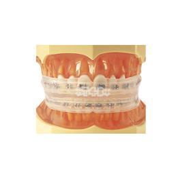 Trainer para Brackets TB4, Myofunctional Lip trainer - unidad