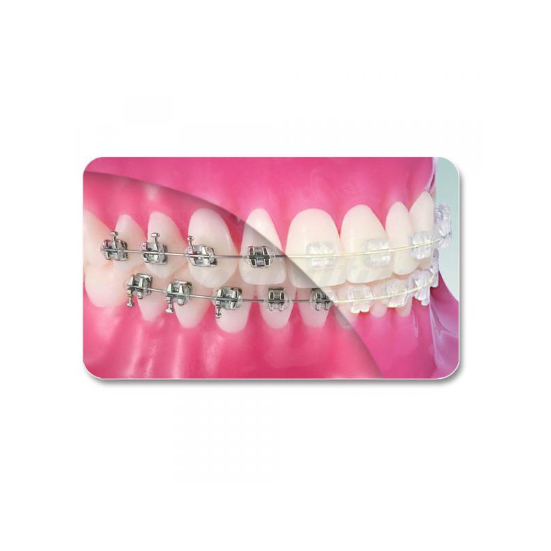 Arcos Estéticos Rhodium FlexyNiti  Orhometric - Unidad