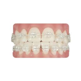 1 caso Zafiro Roth Royal Dent - 20 brackets